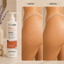 Creme AntiEstrias Removedor Estrias 200g Renovador de Células – Estimula o Colágeno e Elastina