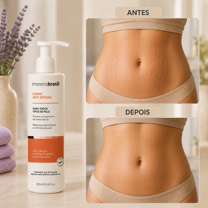 Creme AntiEstrias Removedor Estrias 200g Renovador de Células – Estimula o Colágeno e Elastina