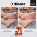 Hidratante para os Pés
