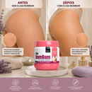 Creme Lisa Bumbum Foliculite Acne e Pelos Encravados Bio Soft 120g